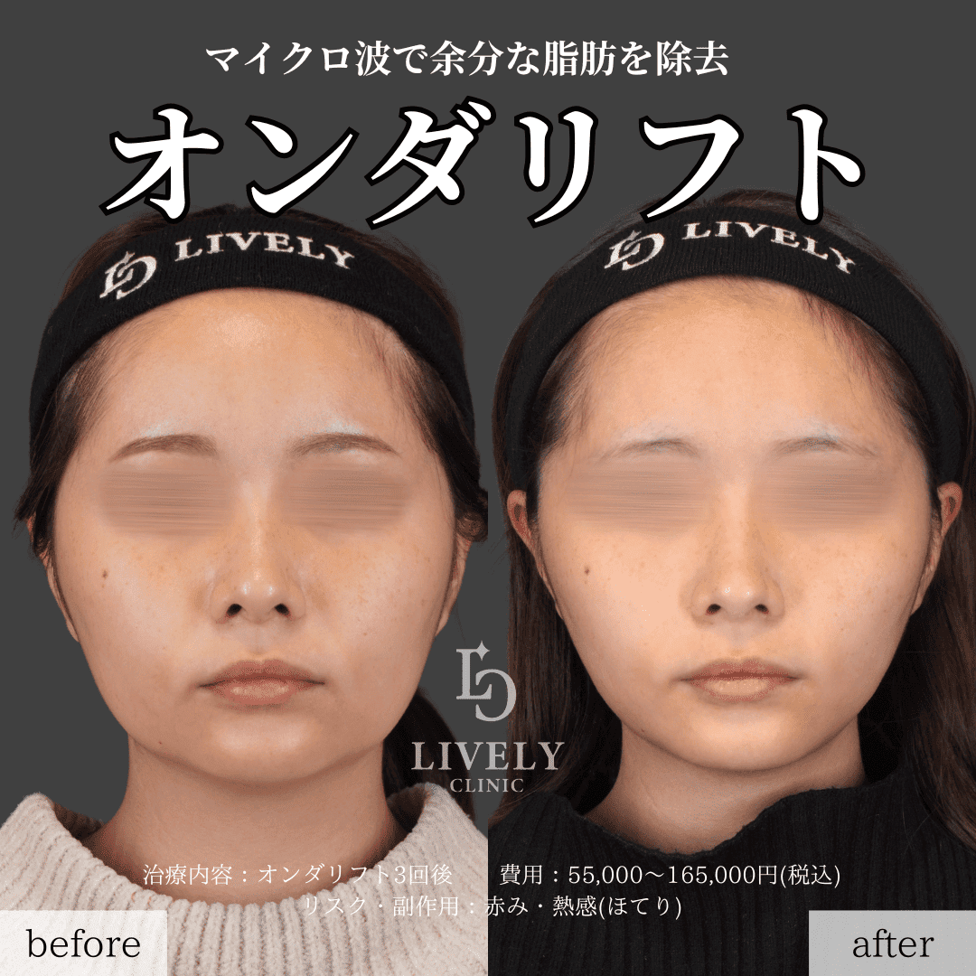 オンダリフト