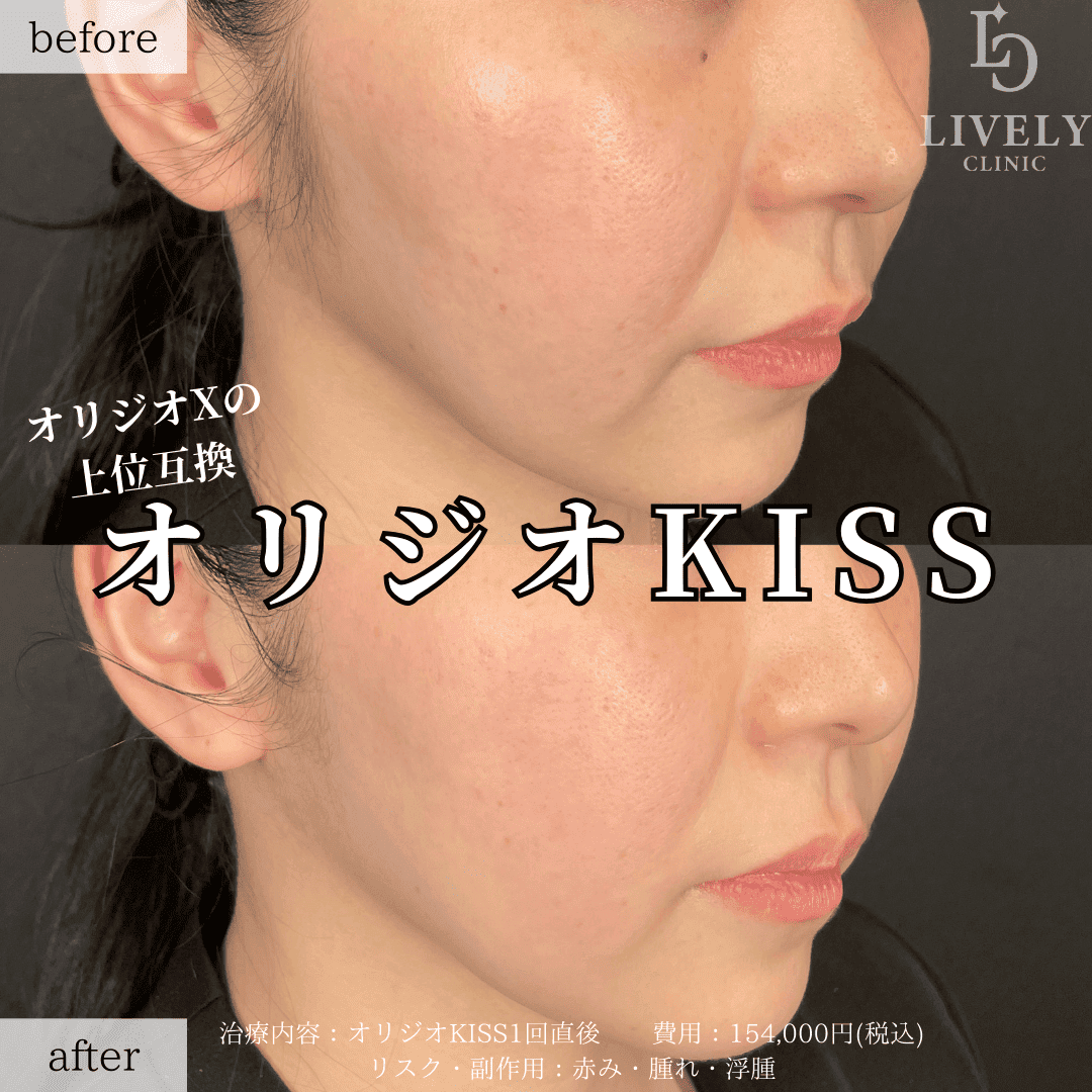 オリジオKISS