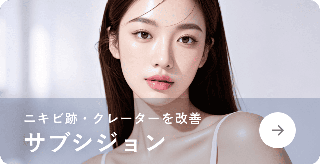 サブシジョン